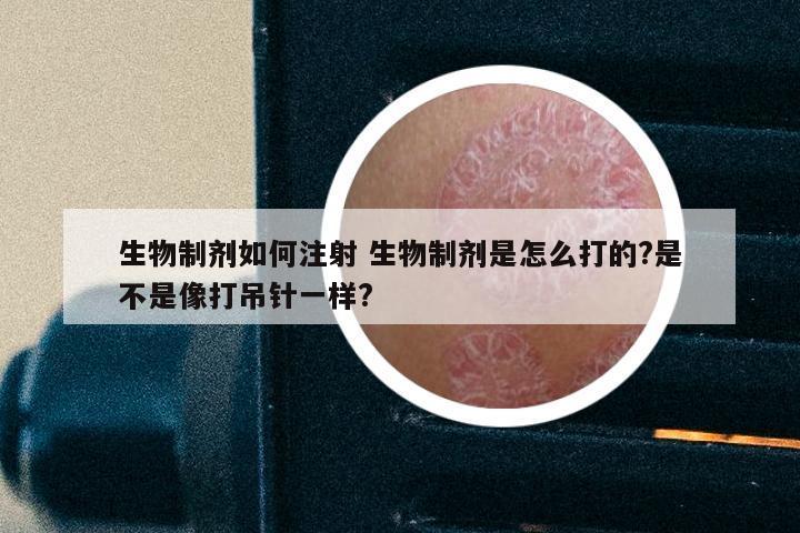 生物制剂如何注射 生物制剂是怎么打的?是不是像打吊针一样?