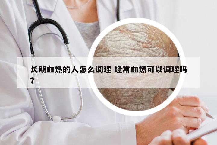 长期血热的人怎么调理 经常血热可以调理吗?