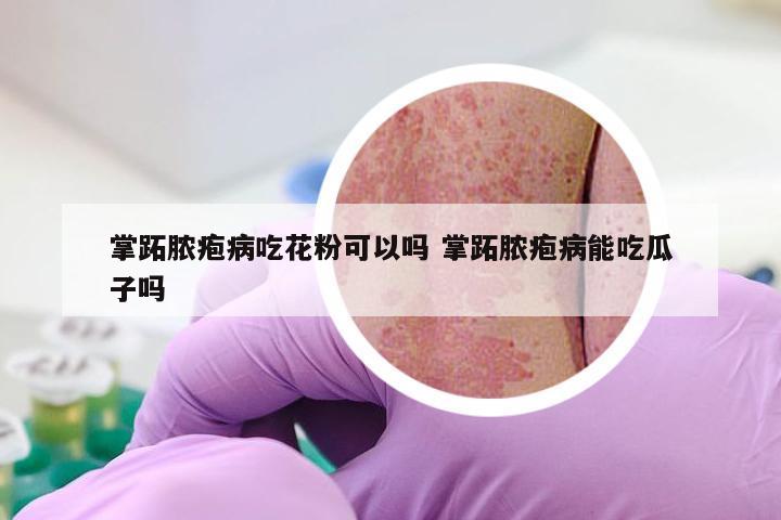 掌跖脓疱病吃花粉可以吗 掌跖脓疱病能吃瓜子吗