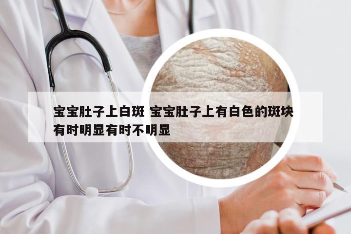 宝宝肚子上白斑 宝宝肚子上有白色的斑块 有时明显有时不明显