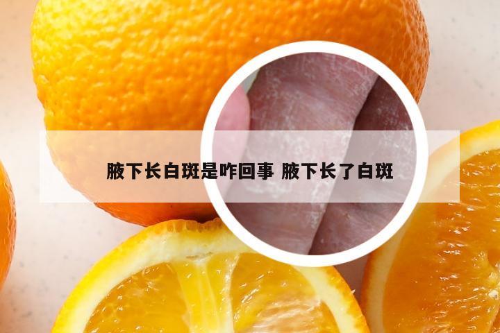 腋下长白斑是咋回事 腋下长了白斑