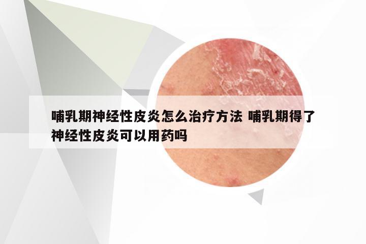 哺乳期神经性皮炎怎么治疗方法 哺乳期得了神经性皮炎可以用药吗