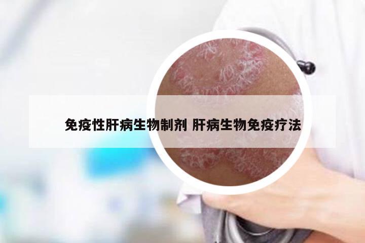 免疫性肝病生物制剂 肝病生物免疫疗法