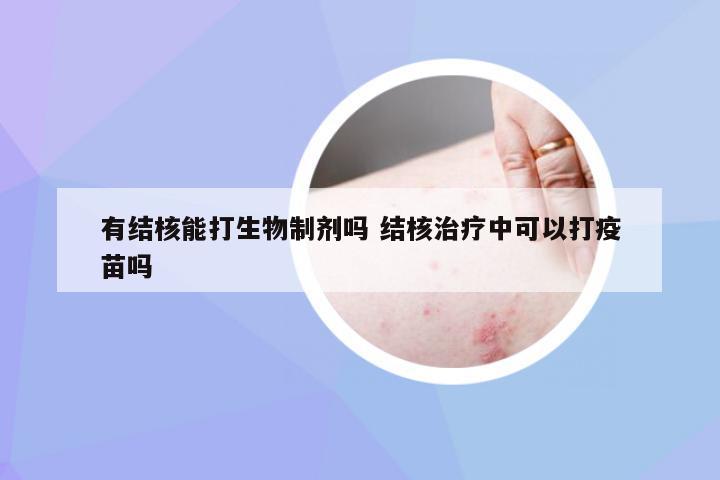 有结核能打生物制剂吗 结核治疗中可以打疫苗吗