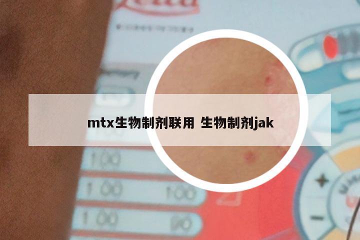 mtx生物制剂联用 生物制剂jak