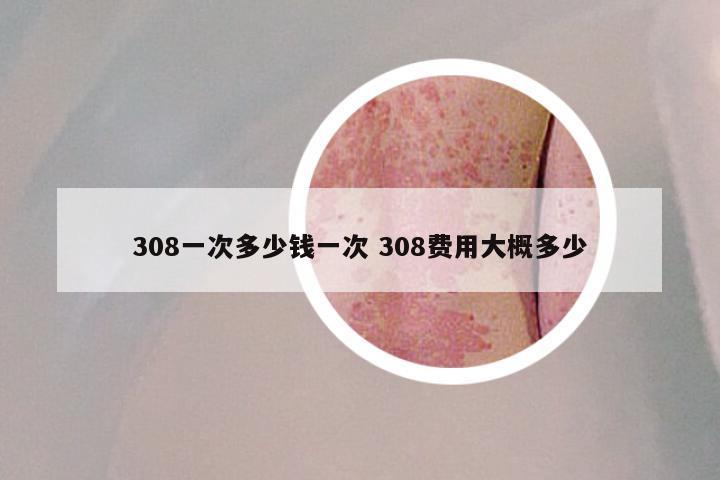 308一次多少钱一次 308费用大概多少