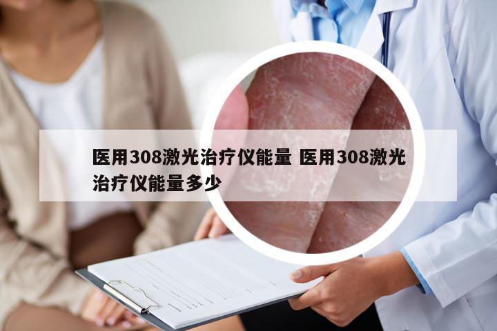 医用308激光治疗仪能量 医用308激光治疗仪能量多少