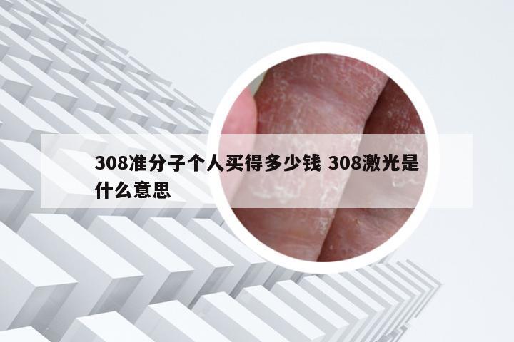 308准分子个人买得多少钱 308激光是什么意思