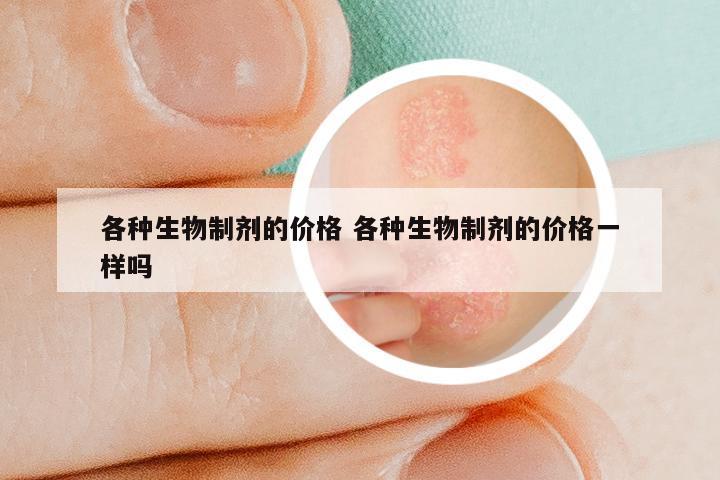 各种生物制剂的价格 各种生物制剂的价格一样吗