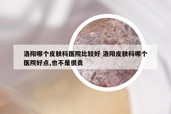 洛阳哪个皮肤科医院比较好 洛阳皮肤科哪个医院好点,也不是很贵