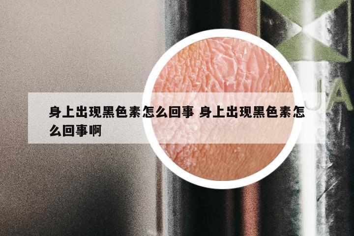 身上出现黑色素怎么回事 身上出现黑色素怎么回事啊