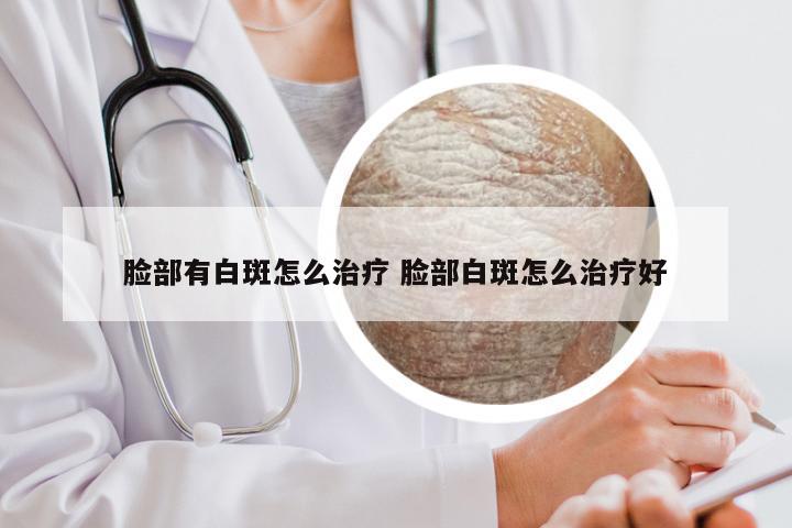 脸部有白斑怎么治疗 脸部白斑怎么治疗好