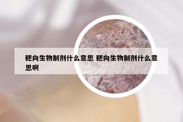 靶向生物制剂什么意思 靶向生物制剂什么意思啊