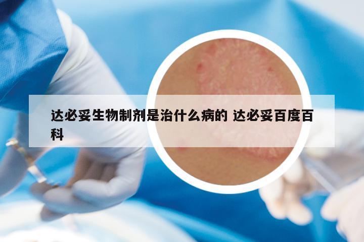 达必妥生物制剂是治什么病的 达必妥百度百科