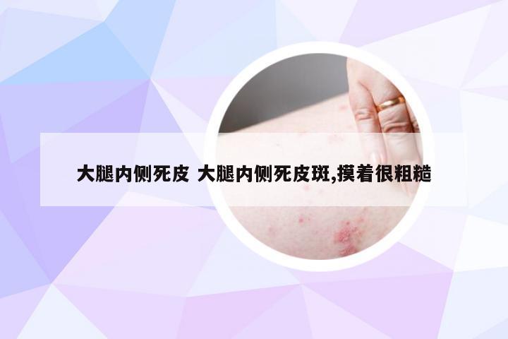 大腿内侧死皮 大腿内侧死皮斑,摸着很粗糙