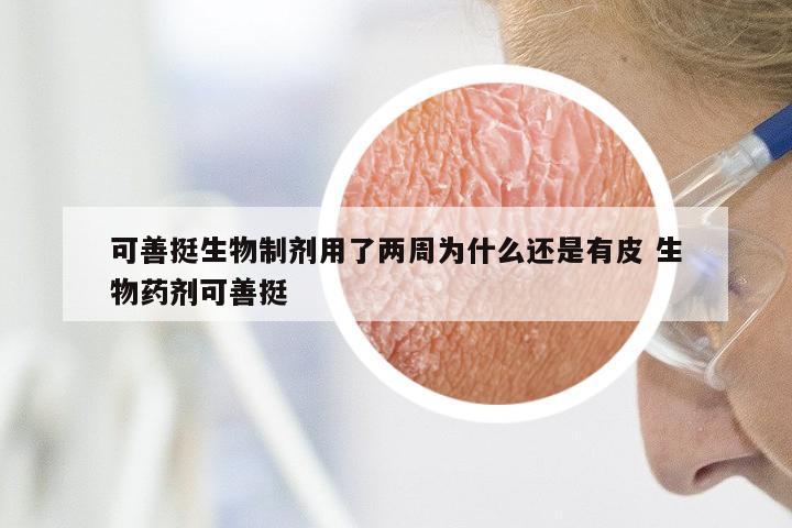 可善挺生物制剂用了两周为什么还是有皮 生物药剂可善挺