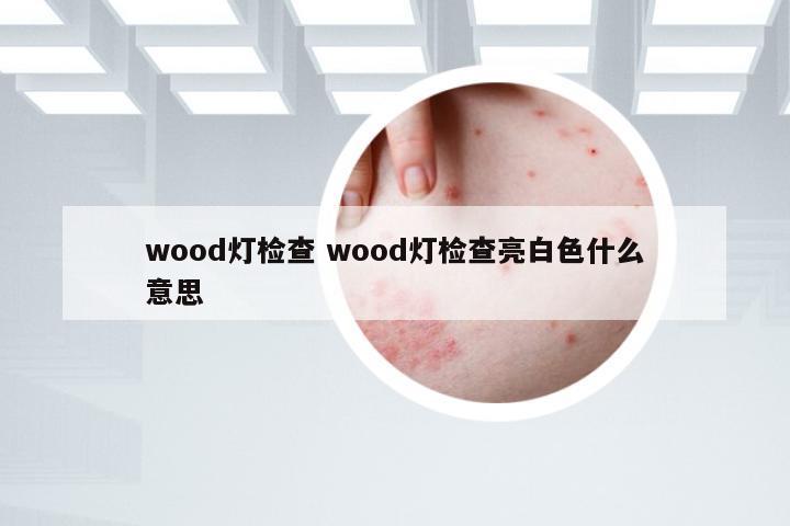 wood灯检查 wood灯检查亮白色什么意思