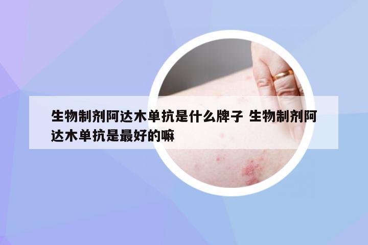 生物制剂阿达木单抗是什么牌子 生物制剂阿达木单抗是最好的嘛