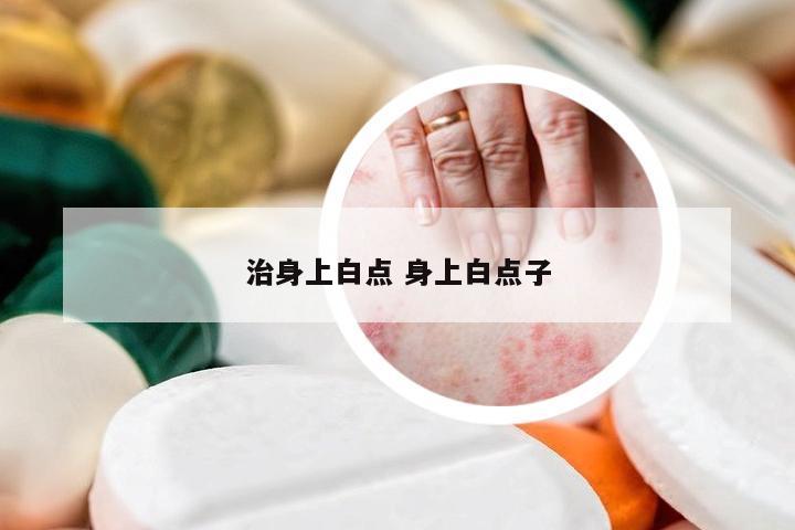 治身上白点 身上白点子