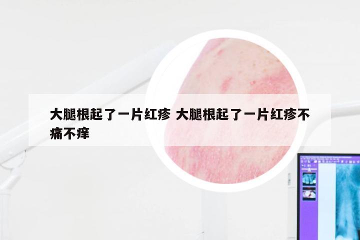 大腿根起了一片红疹 大腿根起了一片红疹不痛不痒