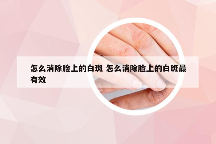 怎么消除脸上的白斑 怎么消除脸上的白斑最有效