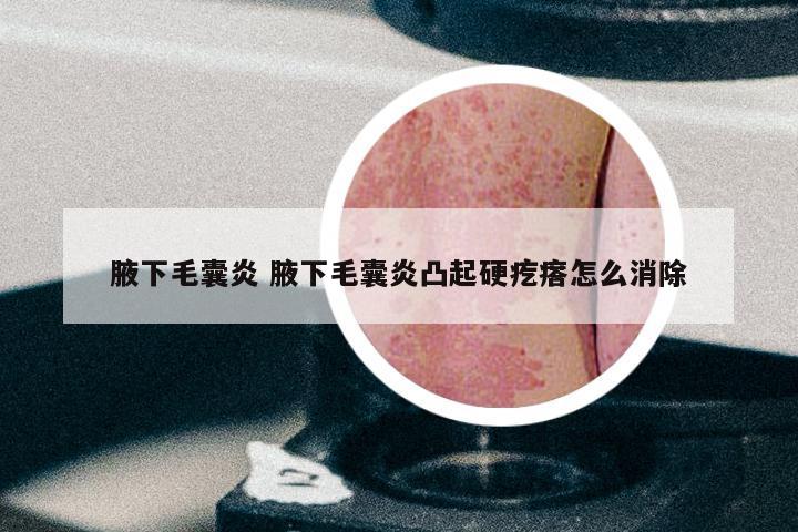 腋下毛囊炎 腋下毛囊炎凸起硬疙瘩怎么消除