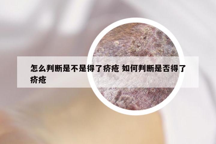 怎么判断是不是得了疥疮 如何判断是否得了疥疮