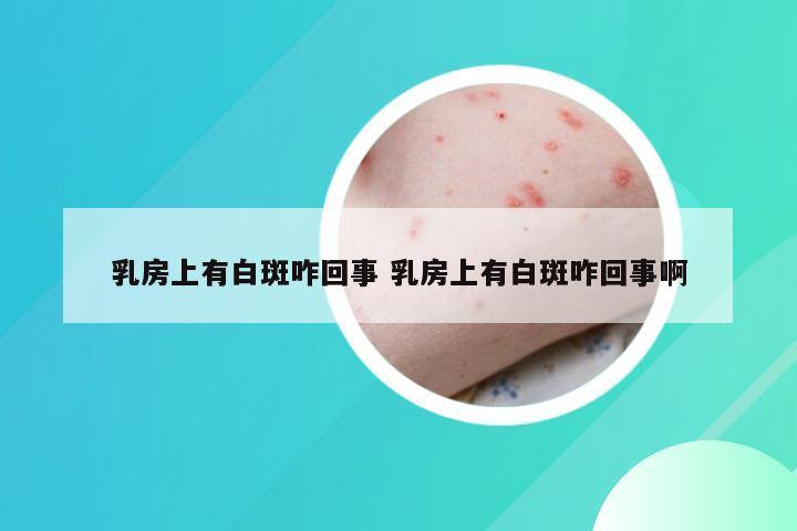 乳房上有白斑咋回事 乳房上有白斑咋回事啊