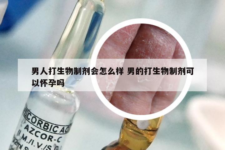 男人打生物制剂会怎么样 男的打生物制剂可以怀孕吗