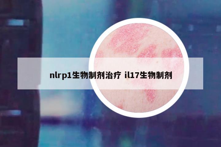 nlrp1生物制剂治疗 il17生物制剂