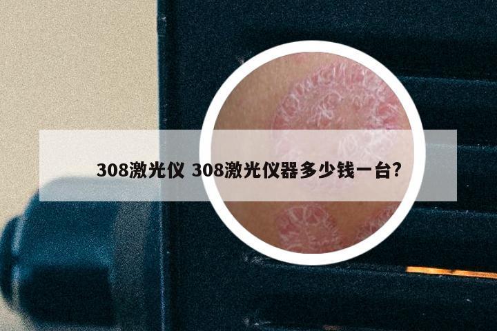 308激光仪 308激光仪器多少钱一台?