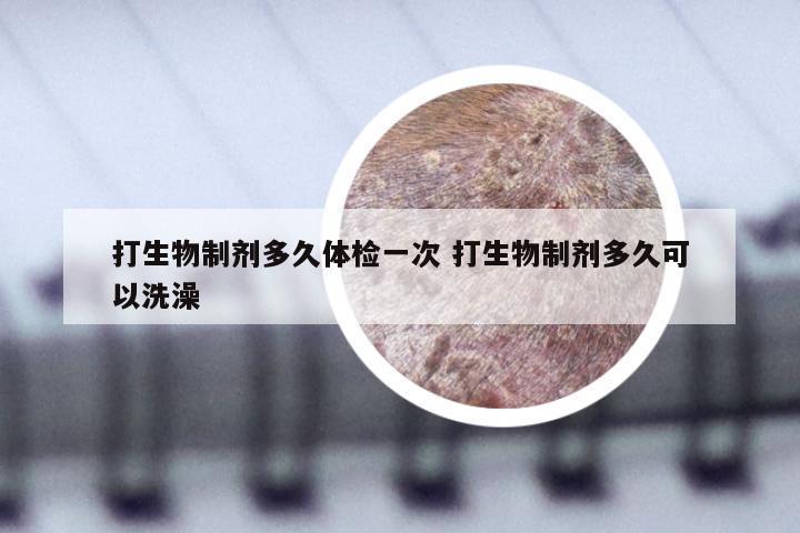 打生物制剂多久体检一次 打生物制剂多久可以洗澡