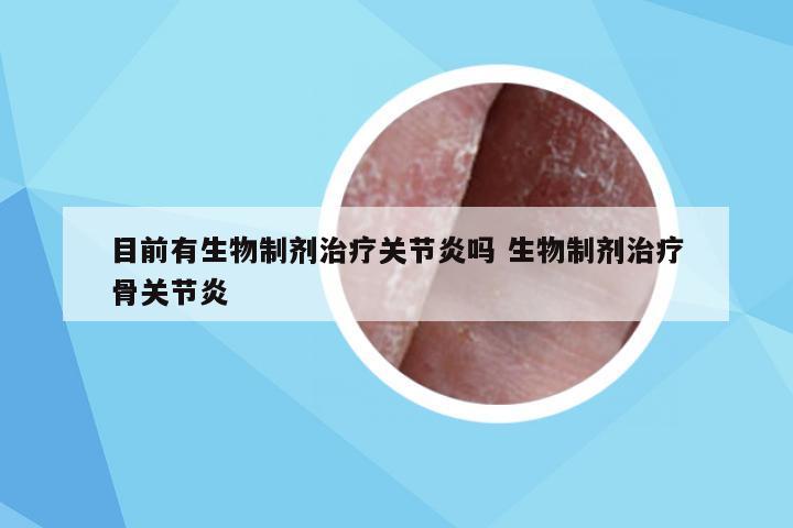 目前有生物制剂治疗关节炎吗 生物制剂治疗骨关节炎