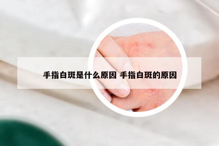 手指白斑是什么原因 手指白斑的原因