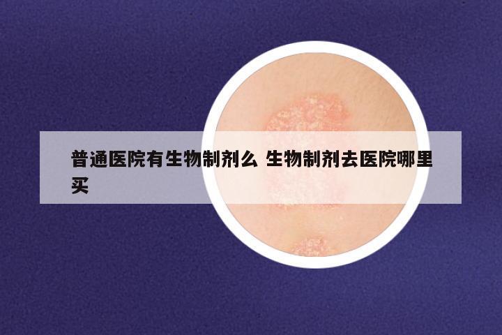 普通医院有生物制剂么 生物制剂去医院哪里买