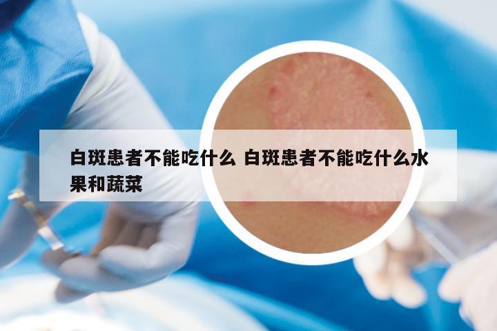 白斑患者不能吃什么 白斑患者不能吃什么水果和蔬菜