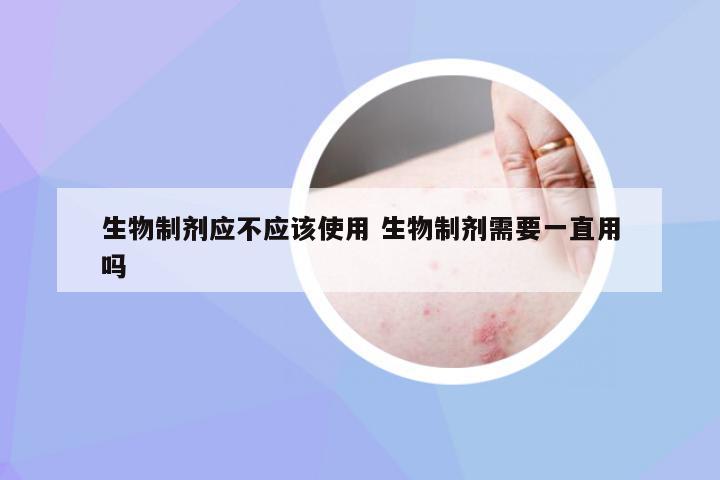 生物制剂应不应该使用 生物制剂需要一直用吗