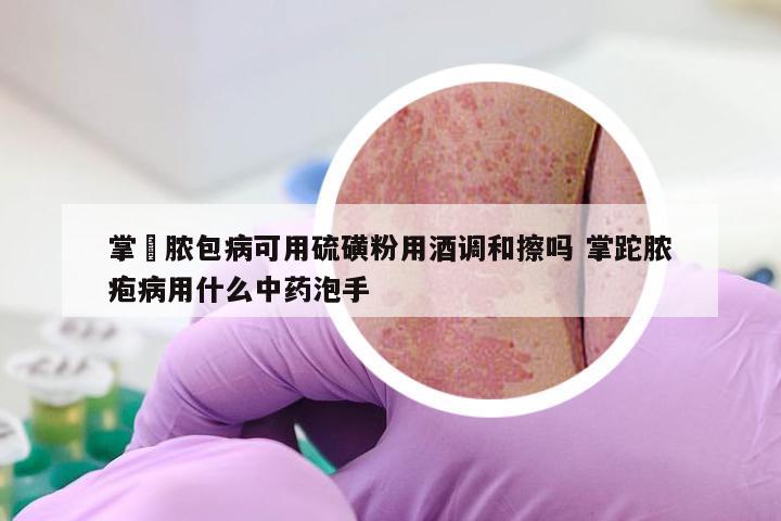 掌砋脓包病可用硫磺粉用酒调和擦吗 掌跎脓疱病用什么中药泡手