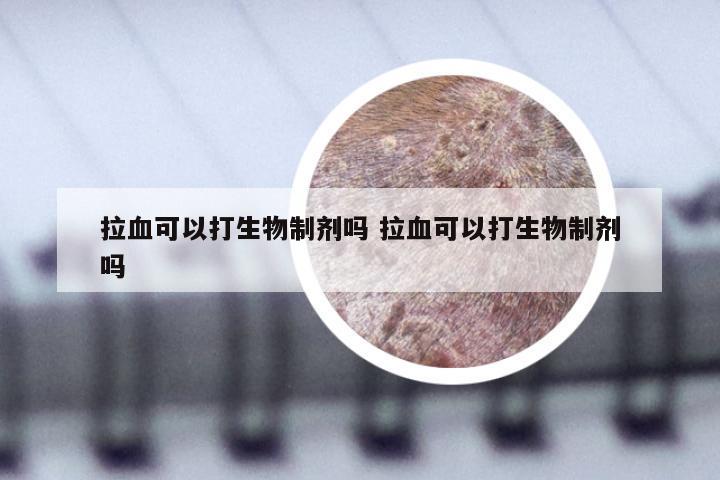 拉血可以打生物制剂吗 拉血可以打生物制剂吗