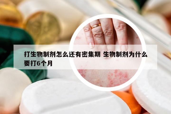 打生物制剂怎么还有密集期 生物制剂为什么要打6个月