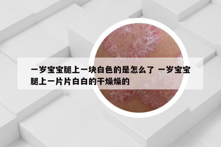 一岁宝宝腿上一块白色的是怎么了 一岁宝宝腿上一片片白白的干燥燥的