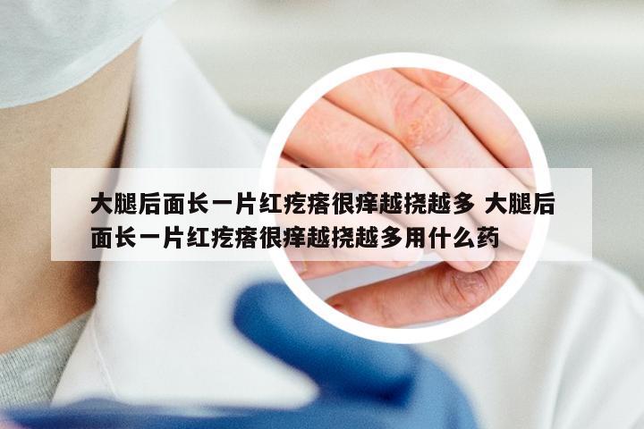 大腿后面长一片红疙瘩很痒越挠越多 大腿后面长一片红疙瘩很痒越挠越多用什么药