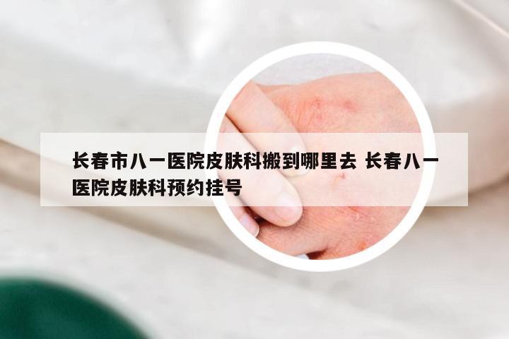 长春市八一医院皮肤科搬到哪里去 长春八一医院皮肤科预约挂号