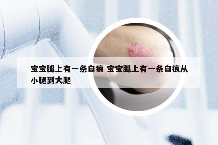 宝宝腿上有一条白痕 宝宝腿上有一条白痕从小腿到大腿