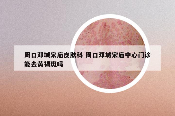 周口邓城宋庙皮肤科 周口邓城宋庙中心门诊能去黄褐斑吗