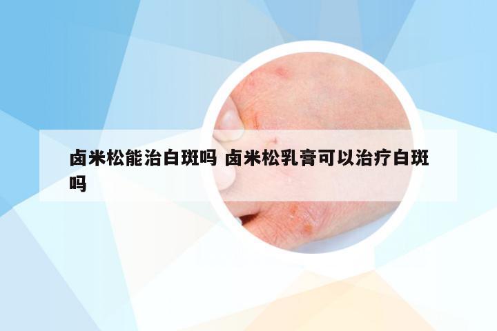 卤米松能治白斑吗 卤米松乳膏可以治疗白斑吗