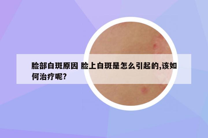 脸部白斑原因 脸上白斑是怎么引起的,该如何治疗呢?