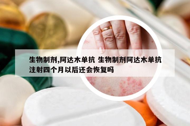 生物制剂,阿达木单抗 生物制剂阿达木单抗注射四个月以后还会恢复吗