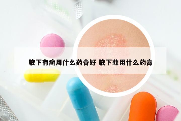 腋下有癣用什么药膏好 腋下藓用什么药膏