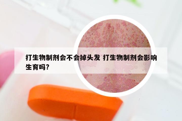 打生物制剂会不会掉头发 打生物制剂会影响生育吗?